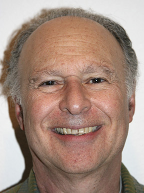 Rob Lasher's face